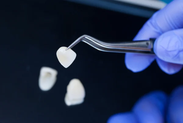 Capsule Dentali Metal Free