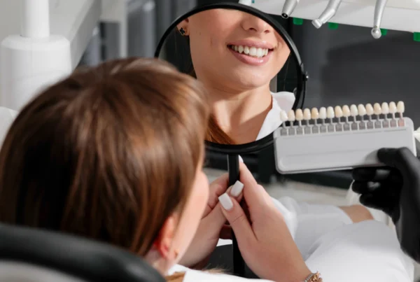 Faccette Dentali