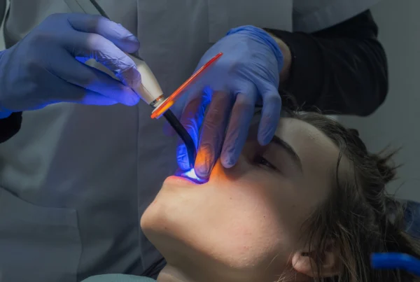 Terapia Parodontite o Piorrea